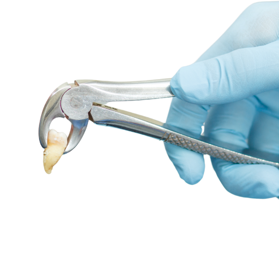 tooth extraction new now